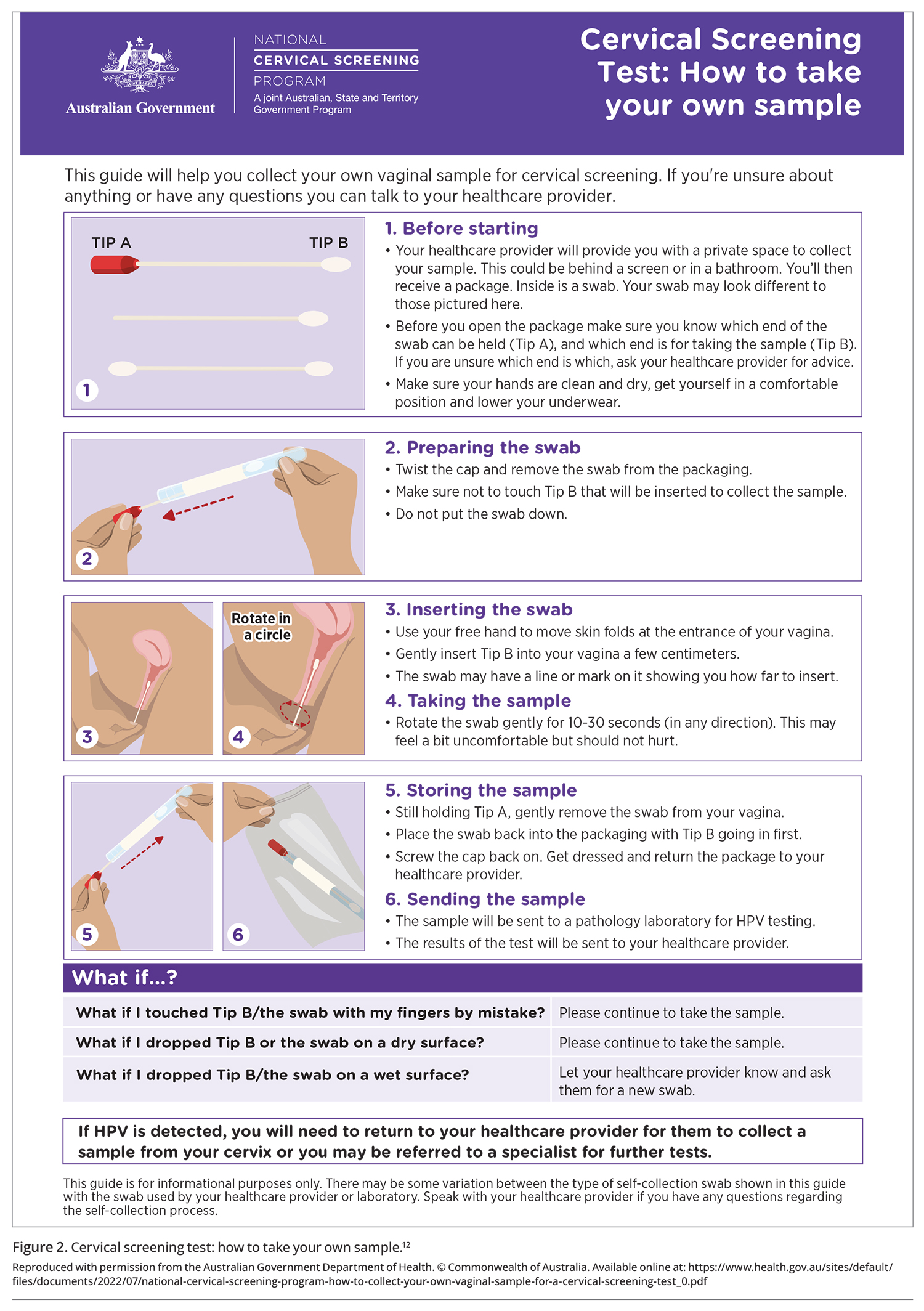 A National Cervical Screening Program Update: A Guide To Self ...